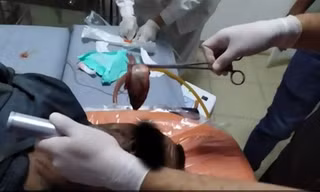 Một người bị con cá sống chui vào cổ họng suýt ngạt thở, lý do thì bạn không tin nổi đâu