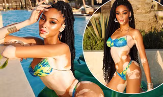 Winnie Harlow thả dáng chuẩn như tạc tượng