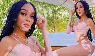 Winnie Harlow thư giãn bên hồ bơi với bikini nhỏ xíu