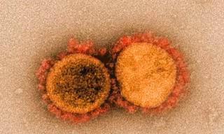 Sự truyền nhiễm của virus SARS-CoV-2 qua ống kính hiển vi điện tử.