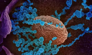 Virus SARS-CoV-2 ( màu xanh) được chụp qua kính hiển vi điện tử.