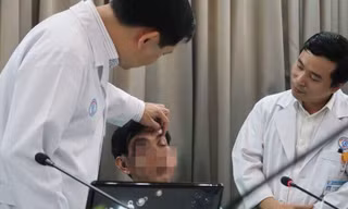 Kinh hoàng gắp hơn 10 mảnh gỗ từ hốc mắt người đàn ông
