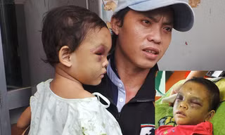 Anh Tố đến Bệnh viện Đa khoa Bình Dương sau khi nghe thông tin cháu Ngân bị bạo hành. Ảnh: Nguyên Hưng