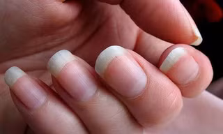 Móng tay có thể phát triển nhanh hơn so với móng chân tùy theo đặc điểm giới tính, chế độ ăn uống hay di truyền. (Ảnh minh họa: Flickr)