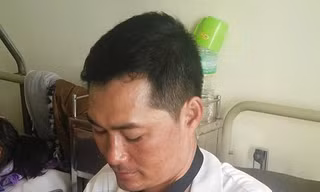 Đuổi cướp, thiếu úy công an bị chém