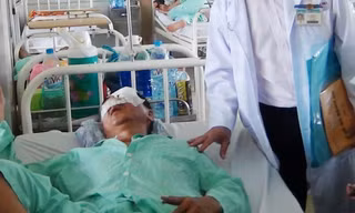 Hành khách bị ném đá hỏng mắt, gãy sống mũi