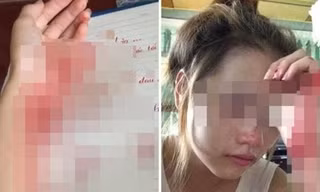 Hình ảnh bàn tay đầy máu và khuôn mặt thảm thương của P.K.M.