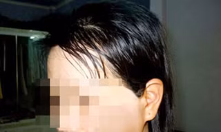 Xung quanh vụ bác sĩ bạo hành vợ ép ly hôn