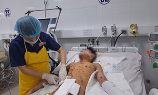 Chơi pháo, bé trai 12 tuổi vỡ ruột, nát tay