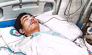Sắp xét xử đối tượng đánh hàng xóm chấn động não, có tính chất côn đồ ở Hưng Yên