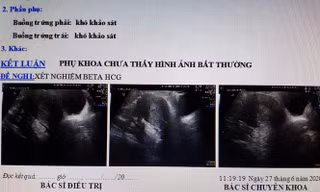Kết quả siêu âm cho thấy chị D. không có thai