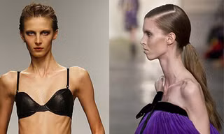 Hãi hùng 'những bộ xương di động' trên sàn catwalk