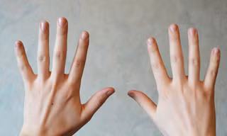 Nhìn móng tay để biết mình có bệnh hay không