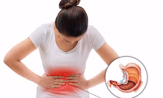 Cách hiệu quả để xử lý cơn đau dạ dày đến bất ngờ