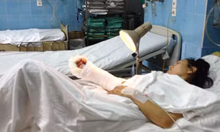 Cô gái đi xe SH bị cướp chém gần lìa tay