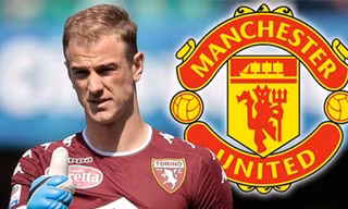 M.U muốn mua Joe Hart để thế chỗ De Gea.