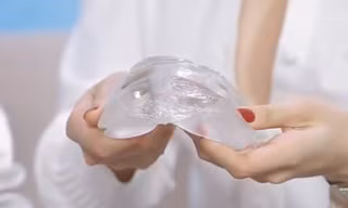 Túi ngực chất liệu gel được sử dụng là gel y tế kết dính và được bảo hành trọn đời.
