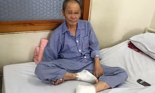 Bệnh nhân bị bỏng nặng ở hai bàn chân. Ảnh: T.N.
