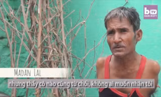 Người đàn ông không tay trở thành thợ may tài ba
