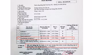 Kết quả thử nghiệm ở Trung tâm kiểm soát bệnh tật. Ảnh: PHCC
