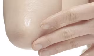 Các bước tự kiểm tra ung thư da