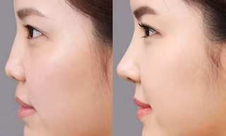 Lột xác 180 độ: Bạn có dám thử