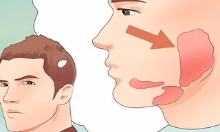 Cha đốt rạ chữa quai bị, con biến chứng viêm màng não