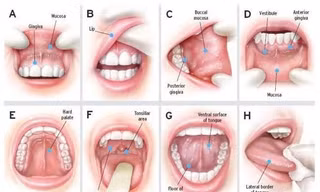 8 bước khám khoang miệng để phát hiện sớm ung thư.