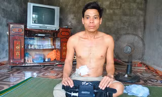 Bệnh nhân đặc biệt và chiếc máy trợ tim bên mình. 