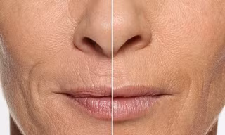 Những điểm lão hóa ở đôi môi làm bạn già đi