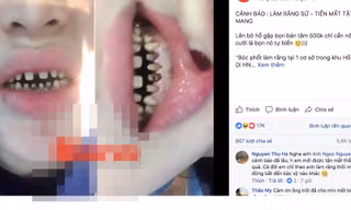  Chị T.N chia sẻ về tình trạng răng sau 2 năm bọc răng sứ.