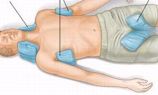 Đặt túi chườm đá ở nách, bẹn giúp làm giảm nhiệt độ ở người bị sốc nhiệt do nắng nóng