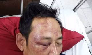 Vụ người đàn ông bị đánh ‘thập tử nhất sinh’ ở Quảng Bình: Nguyên nhân từ bài thơ đăng trên facebook 