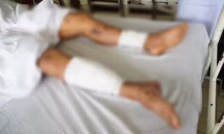 Đắk Lắk: Tự chế pháo nổ tại nhà, 2 nam sinh thương vong 