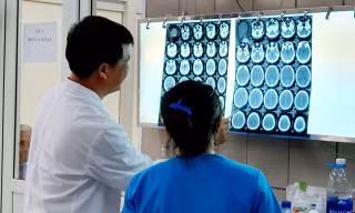 Lần đầu tiên Việt Nam ghi nhận ca xuất huyết não do ma tuý đá