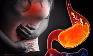‘Trào ngược dạ dày thực quản’ – Bệnh lối sống đang gia tăng ở Việt Nam