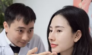 Ham nâng mũi rẻ ở spa thẩm mỹ gặp biến chứng vẹo lệch có sửa lại được không?