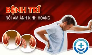 Cảnh báo: Bệnh trĩ không điều trị sớm nguy hiểm thế nào? 
