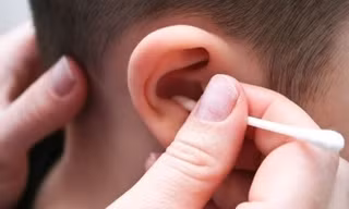 Bé trai 5 tuổi bị thủng màng nhĩ do ngoáy tai