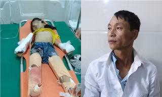 Nỗi đau của người bố có 3 con nhỏ nguy kịch sau vụ nổ kinh hoàng tại gara ô tô ở Nghệ An