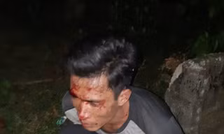 Nhiều công an nguy cơ phơi nhiễm HIV khi vây bắt 'sưa tặc'
