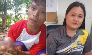 Chú heo con ở Philippines có khuôn mặt giống người, bác sĩ giải thích thế nào?