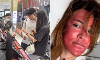 Khuôn mặt của người phụ nữ 22 năm không tẩy trang cho thấy da bị tổn hại thế nào