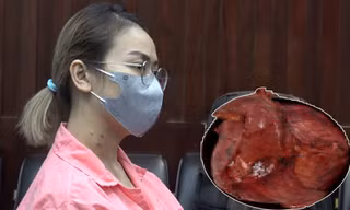 Bệnh nhân bị khối u tụy khổng lồ.