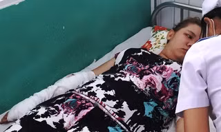 Vết thương trên cánh tay chị Yến dài 20 cm. Ảnh: Hải Hiếu