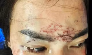 Khởi tố vụ án người phụ nữ 'tố' bị bắt giữ, đánh đập, xăm mặt vì ghen 