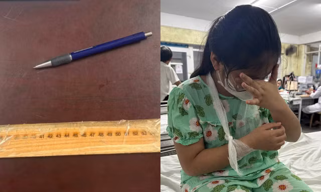 Thông tin cô giáo ở Huế "đánh gãy tay" học sinh lớp 4 là không chính xác