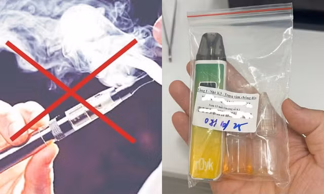 Nam sinh 15 tuổi bị tổn thương não do hút thuốc lá điện tử có chứa chất cấm