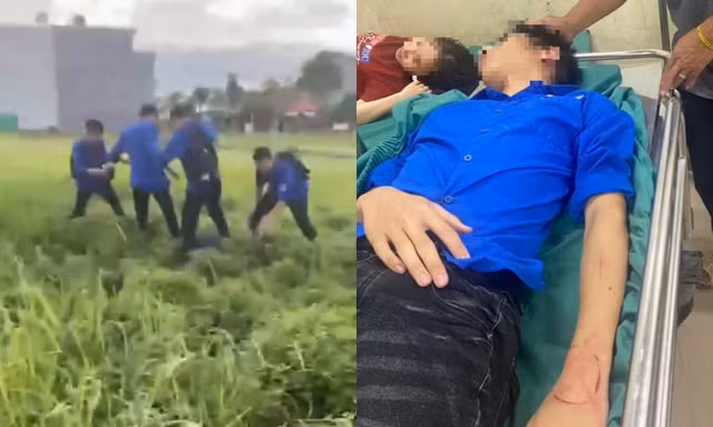Hải Phòng: Nam sinh lớp 11 bị nhóm bạn đánh gãy xương mũi, phải nhập viện điều trị