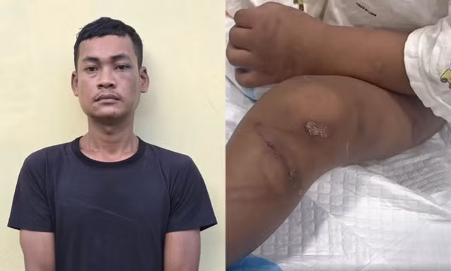 Hai vụ bạo hành trẻ em gây rúng động: Bé 4 tuổi tử vong, bé 2 tuổi nguy kịch